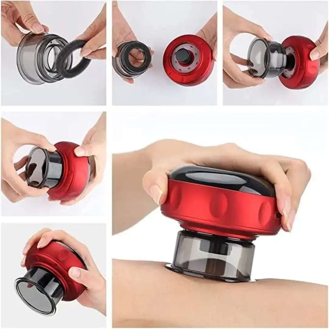 Smart Electric Cupping Massager – Vacuum Therapy, Red Light & Heat Therapy Device