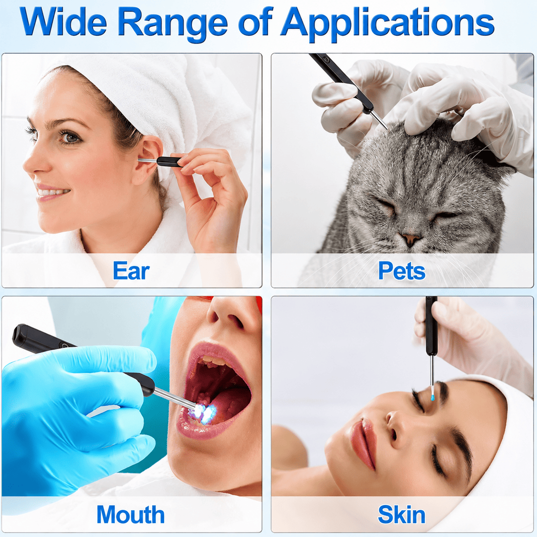 Smart WiFi Ear Cleaner with HD Camera – Visual Ear Wax Removal Tool