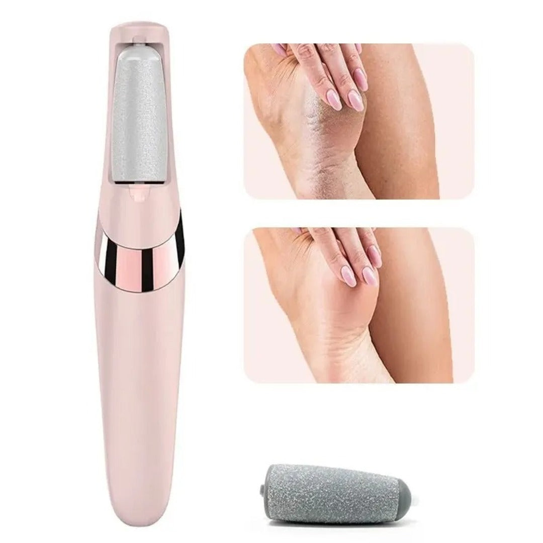 Electric Foot Callus Remover – Rechargeable Pedicure Foot File for Smooth Heels